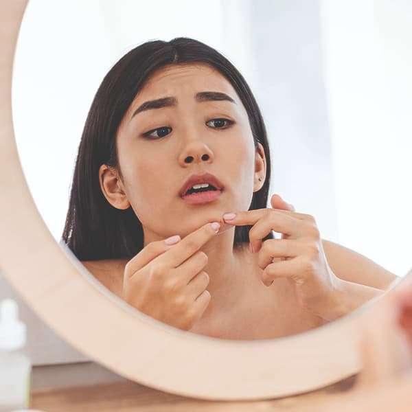 Prescription Strength Acne Treatment