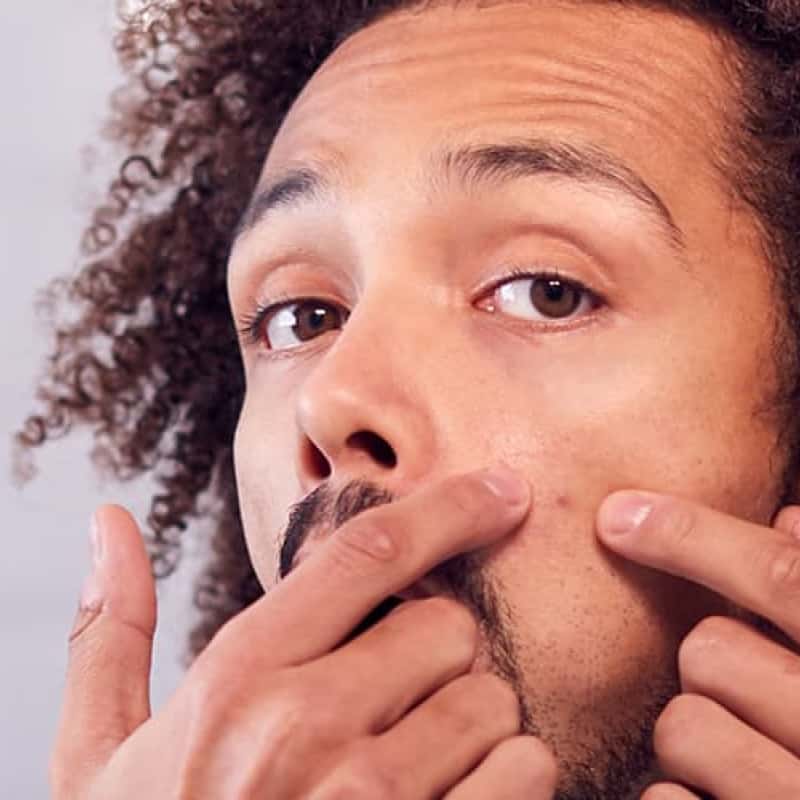 Acne in men, young men looking at skin the bathroom mirror