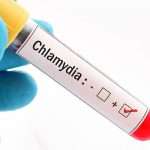 Chlamydia: The Silent STI