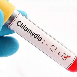 Chlamydia: The Silent STI