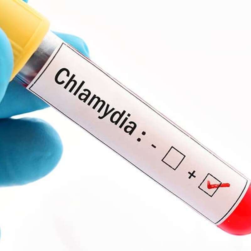 Pharmacist in blue gloves holding test tube marked Chlamydia, Chlamydia is a silent STI, e-Surgery